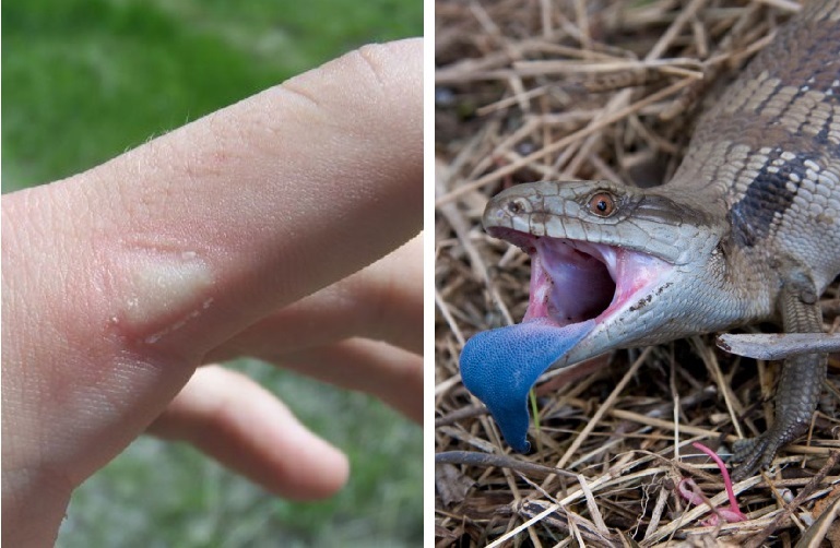 blue tongue skink teeth